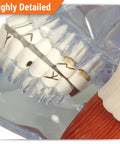 Close-up of Temporomandibular Joint TMJ Model With Pathologies For Human Anatomy And Physiology Education showing teeth detail.