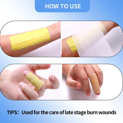 Game Changer Burn Relief Kit With Instant Cooling Gel Non Sticky Dressings Nitrile Gloves And Medical Shears For Quick First Aid That Soothes Burns Fast No Drama Needed Your Go To Emergency Kit