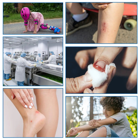 Collage showing various wounds needing 100 Pcs Blue Bandages 3 By 1 Inch Metal Detectable Waterproof PE Adhesive Bandages For Food Handling And Kitchen Use High Visibility Latex Free Non Stick Pad Bulk First Aid Wound Care Food Safety