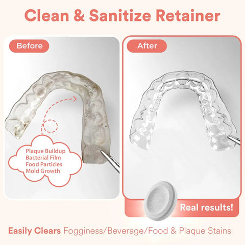 Daily Retainer Cleaner Tablets For Invisalign And Night Guards That Removes Stains Odors And Plaque In Minutes Before After