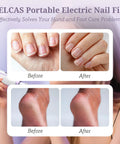 Before and after results showing hands and feet using Cordless Electric Foot File For Crusty Thick Toenails And Hard Calluses Packs Eight Swappable Carving Heads Plus Rugged Sanding Collars For No Sweat Salon Ready Pedicure Results.
