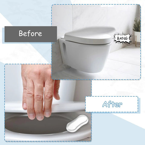 20 Pack Clear Toilet Seat Bumpers Replacement Kit For Bidet And Lid Universal Fit Includes 4 Large And 16 Small PU Cushions Game Changer
