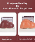 Hella Realistic Silicone Liver Anatomy Set Featuring Three Straight Up Life Size Medical Teaching Models With Normal And Fatty Liver Versions side-by-side comparison
