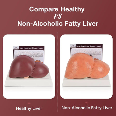 Hella Realistic Silicone Liver Anatomy Set Featuring Three Straight Up Life Size Medical Teaching Models With Normal And Fatty Liver Versions side-by-side comparison