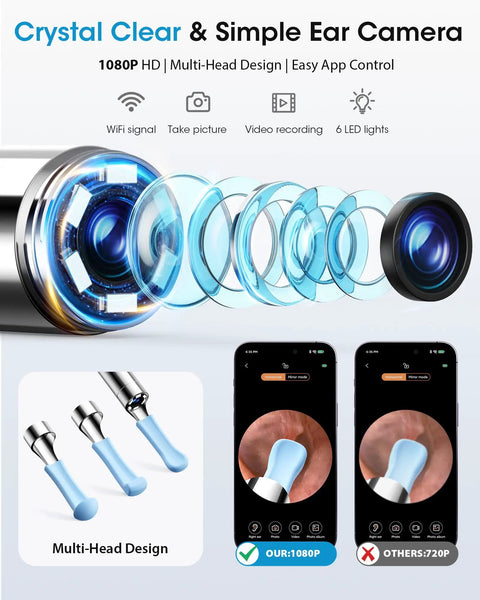 Easy At Home Ear Wax Removal Kit With Camera For Safe Gentle Ear Cleaning Visual Inspection Ear Camera showing multi-head design