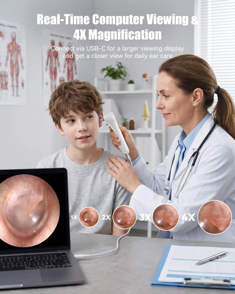 1080P Ear Camera With Light For Easy Home Checks Otoscope For Adults And Kids 1.21 Inch IPS Screen, doctor using USB-C ear check