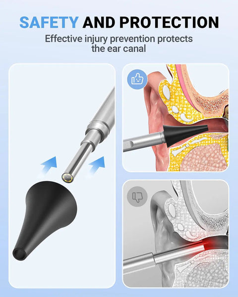 Home Ear Otoscope With 4.5 Inch IPS Display And 3.9mm Ear Camera With Gyroscope For Clear At Home Inspection, black silicone ear tip