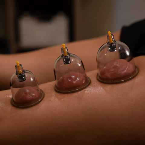 Ultimate Pro Cupping Therapy Set With 18 Multi Sized Vacuum Cups Two Hand Pumps And Detailed Cupping Guide on skin during therapy