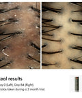Close-up of scalp before and after using Amino11 Leave-In Scalp Bubble Treatment With Barley Grown On Farms over 84 days