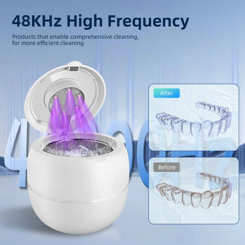 Cordless Ultrasonic Retainer Cleaner With 48kHz Vibration, 210ml Tank, 6 UV Lamps, showing cleaning effect on aligners