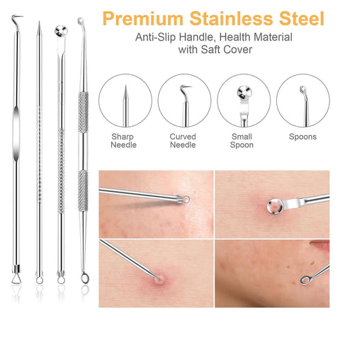 9-In-1 Pimple Popper Kit With 16 Precision Heads, Blackhead Remover Tools Set, 304 Stainless Steel Comedone Extractors demo