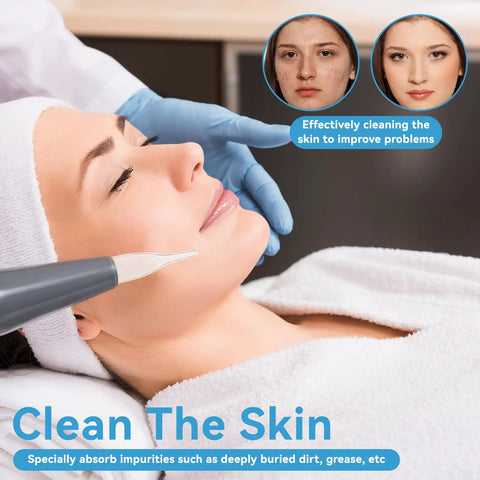 Facial treatment with 3pc Vacuum Glass Tube Kit for Face Suction Blackhead Removal and Pore Vacuum Cleaner Deep Clean Tool Set