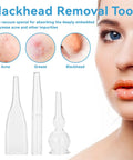 3pc Vacuum Glass Tube Kit for Face Suction Blackhead Removal and Pore Vacuum Cleaner Deep Clean Tool Set with acne close-ups