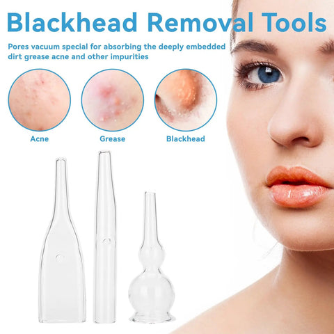 3pc Vacuum Glass Tube Kit for Face Suction Blackhead Removal and Pore Vacuum Cleaner Deep Clean Tool Set with acne close-ups
