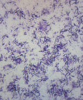 Escherichia Coli Smear With Gram Stain Prepared Microscope Slide 75 x 25mm For Biology Class And Microscopy Education Hands On Lab Prep Whole Mount For Science Classrooms And Home Lab Use, gram-stained bacteria under microscope