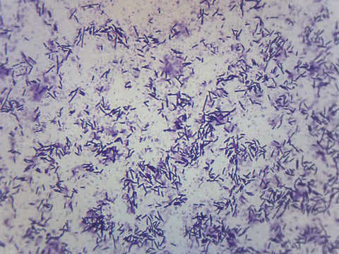 Escherichia Coli Smear With Gram Stain Prepared Microscope Slide 75 x 25mm For Biology Class And Microscopy Education Hands On Lab Prep Whole Mount For Science Classrooms And Home Lab Use, gram-stained bacteria under microscope