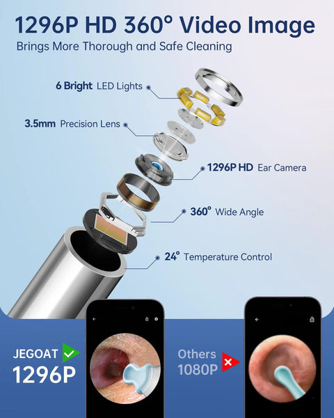 Exploded view of 1296P HD otoscope with 6 LED lights, precision lens, and comparison images on phones for ear cleaning.