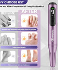 Before and after comparison of Heavy Duty Electric Nail Drill Kit With Twelve Versatile Bits For Grinding Gel And Acrylic Nails.