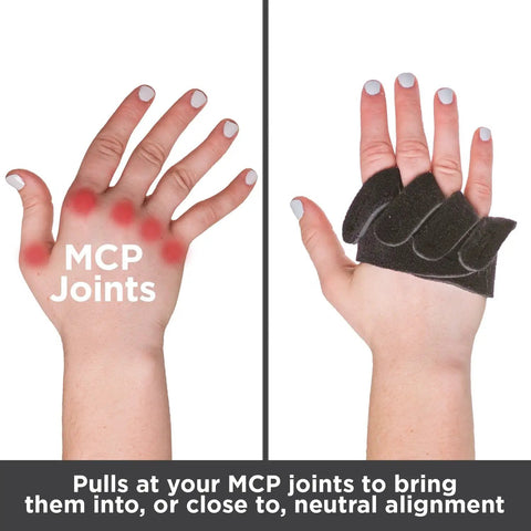 Ulnar Deviation Hand Splint With MCP Joint Support For Rheumatoid Arthritis And Tendonitis Pain Relief Finger Straightener