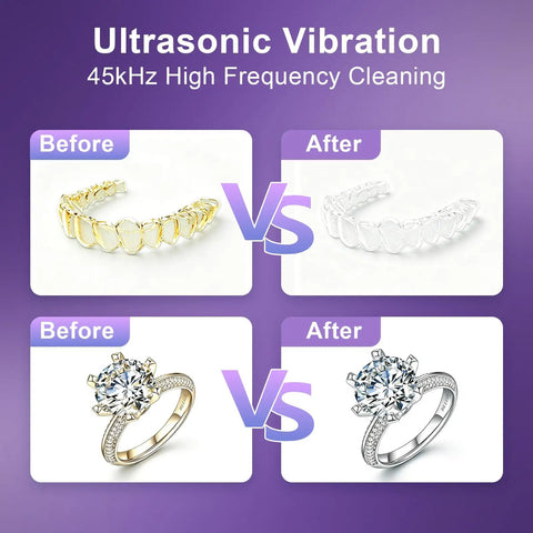 Before and after of Dual Ultrasonic And UV Retainer Cleaner For Dentures And Invisalign, 45kHz Deep Cleaning with UV light