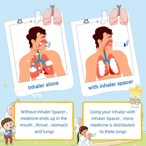 Comparison of medicine distribution with inhaler alone versus Kid And Adult Friendly Inhaler Spacer Kit With Two Masks