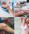 Applying Straight Up Legit Isopropyl Rubbing Alcohol 70 Percent Usp Grade First Aid Antiseptic on a child's cut.
