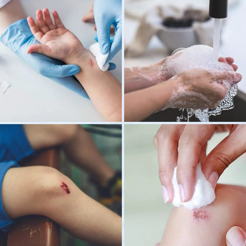 Applying Straight Up Legit Isopropyl Rubbing Alcohol 70 Percent Usp Grade First Aid Antiseptic on a child's cut.