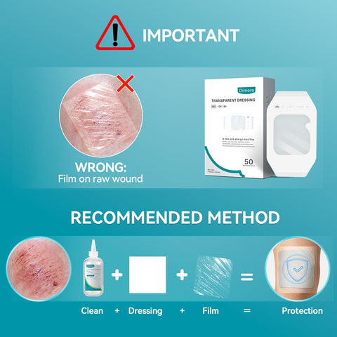 Instruction for applying Transparent Film Dressing 50 Pack No Hassle Waterproof Clear Bandages 4 By 5 Inches Hypoallergenic Latex Free Adhesive Wound Cover