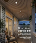Covered patio with Dope 4 Inch LED Recessed Lights Kit Dimmable With Adjustable CCT 2700K To 5000K, installed on ceiling
