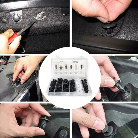Must Have Car Plastic Rivet Clips Kit 100 Pcs In Six Sizes for bumpers and interior panels in use with storage box