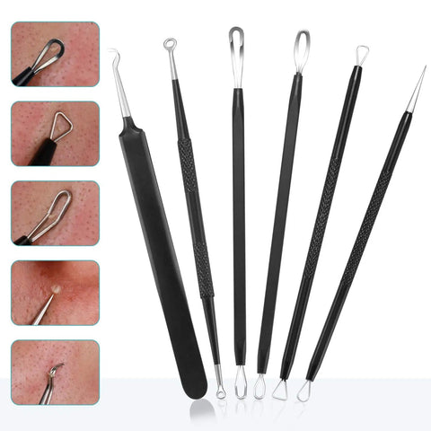 6 Piece Pimple Popper Kit with stainless steel comedone extractors featuring textured grips for blackhead removal and acne control.