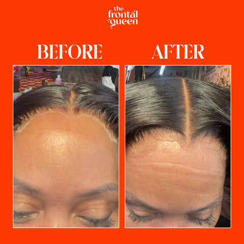 Before and after results using Lace Melting Spray For Wigs With Extra Hold No Residue Bond Adhesive Ashy Lace Eliminator Game Changer.