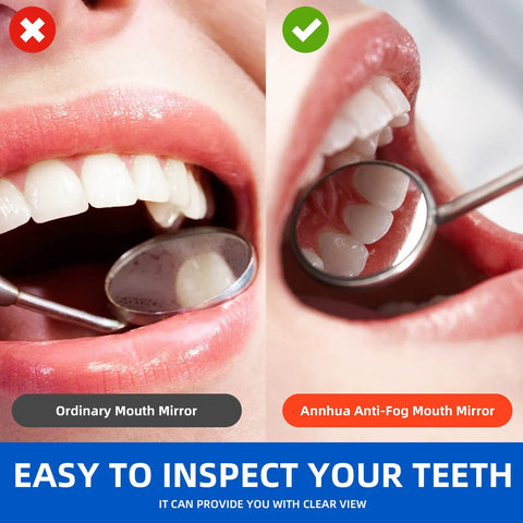 Pro Grade Stainless Steel Dental Inspection Mirror With Anti Fog Surface Curved Mouth Mirror Tool For Oral Care And Makeup Mini Reflector Non Slip Grip Durable Dental Instrument showing clear teeth inspection
