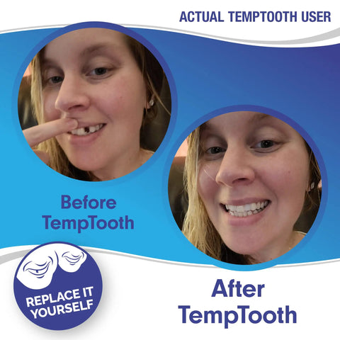 Temporary Tooth Replacement Kit For A Confident Smile That Looks Natural And Discreet Patented And Trusted Bead Based Solution You Can Use At Home For A Quick Easy Smile Fix, before and after user testimonial
