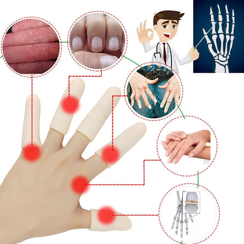 Gel Finger Cots 14 Piece Set Soft Gel Finger Sleeves For Trigger Finger Hand Eczema Finger Cracking Arthritis displayed on a hand.