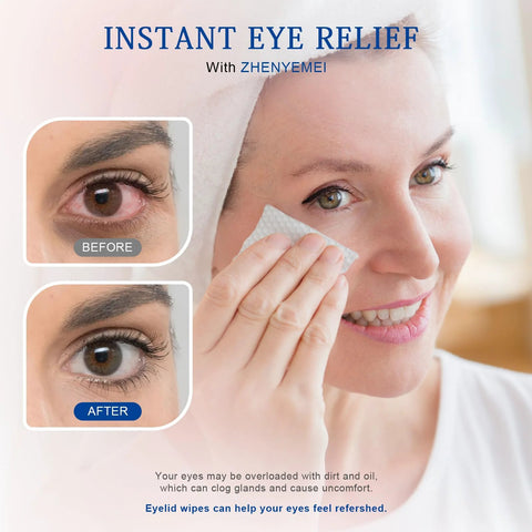 Woman using Tea Tree Eyelid Cleansing Wipes For Eyes And Makeup Removal Saline Rinse Travel with before and after eyes close-up.