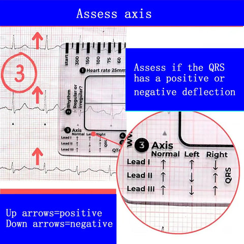 Triple Pack ECG 7 Step Ruler Set For ECG EKG Interpretation, Transparent Plastic Calipers Measuring Tool with axis guide
