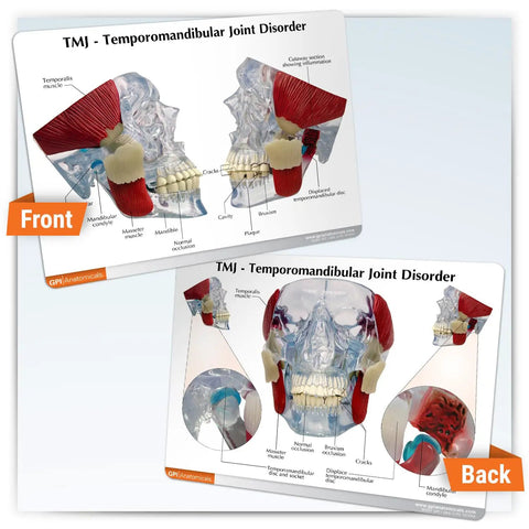 Front and back views of Temporomandibular Joint TMJ Model With Pathologies For Human Anatomy And Physiology Education diagrams.
