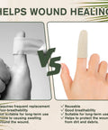 Cotton Finger Cots 20 Pack For Cracked Skin And Eczema Calluses Moisture Wicking Breathable Hand Protection For Men And Women Short Length Comfort Fit versus traditional finger bandage image