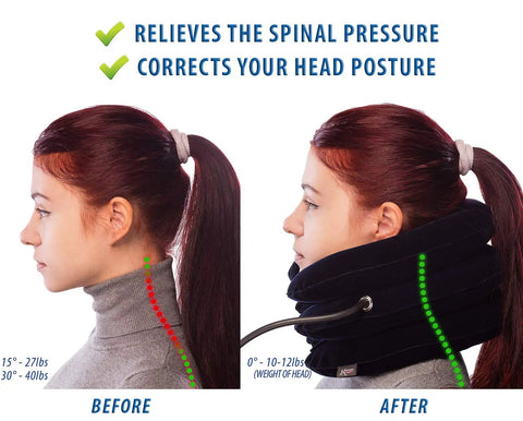 Side profile of person using Neck Traction Device For Home Pain Relief With Inflatable Cervical Stretcher Collar Easy Adjustable Pinched Nerve Relief And Spinal Decompression For Herniated Disc And Muscle Strain Recovery Kit Blue with text.