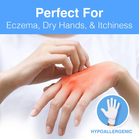 Hands with red eczema using Moisturizing Eczema Cotton Gloves Large Pack 24 Pairs For Hand Care Hypoallergenic Ultra Comfy Fit