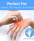 Hands with red eczema spot, with Moisturizing Eczema Cotton Gloves Extra Large 24 Pairs For Dry Hands Hydration inset image