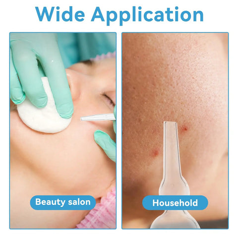 Wide application of 3pc Vacuum Glass Tube Kit for Face Suction Blackhead Removal in salon and home settings