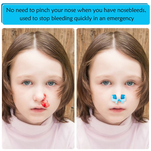 Nose clip for nosebleeds; blue plastic nasal clip shown on a child's nose in the after panel, with nosebleed visible in the before panel.
