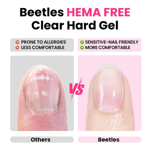 Comparison of nails using others vs. Hema Free Hard Gel Kit 9 in 1, highlighting allergy and comfort benefits.