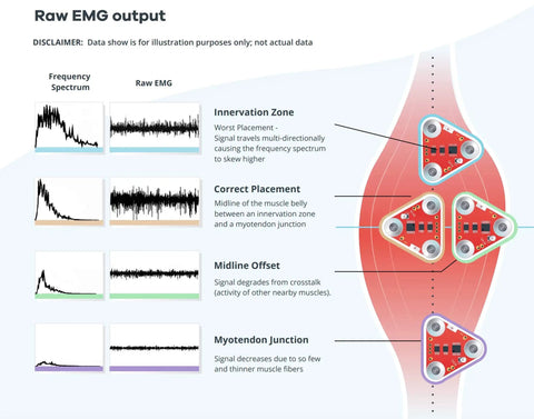Raw EMG output illustration showing signal differences for Straight Up Badass Muscle Sensor Module Featuring High Performance Emg Technology.