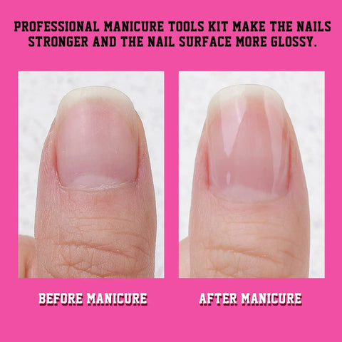 Comparison of nails before and after using All In One Nail Care Kit With Double Sided 100 180 Grit Files Buffers Cuticle Nippers