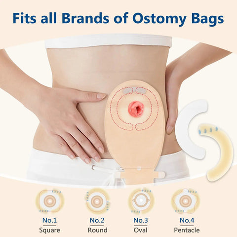 Person demonstrating Ostomy Barrier Strips 20 Pack 2mm Thick Elastic Colostomy Tape To Stop Leaks on abdomen, fits all bag shapes.