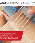 Emergency Laceration Closure Kit With Three Individually Packaged Closures for quick wound repair without stitches application
