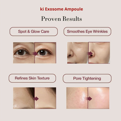 Before and after using Stem Cell Exosome Skin Booster Kit with Exosome PDRN Peptide and Collagen for anti-aging glow